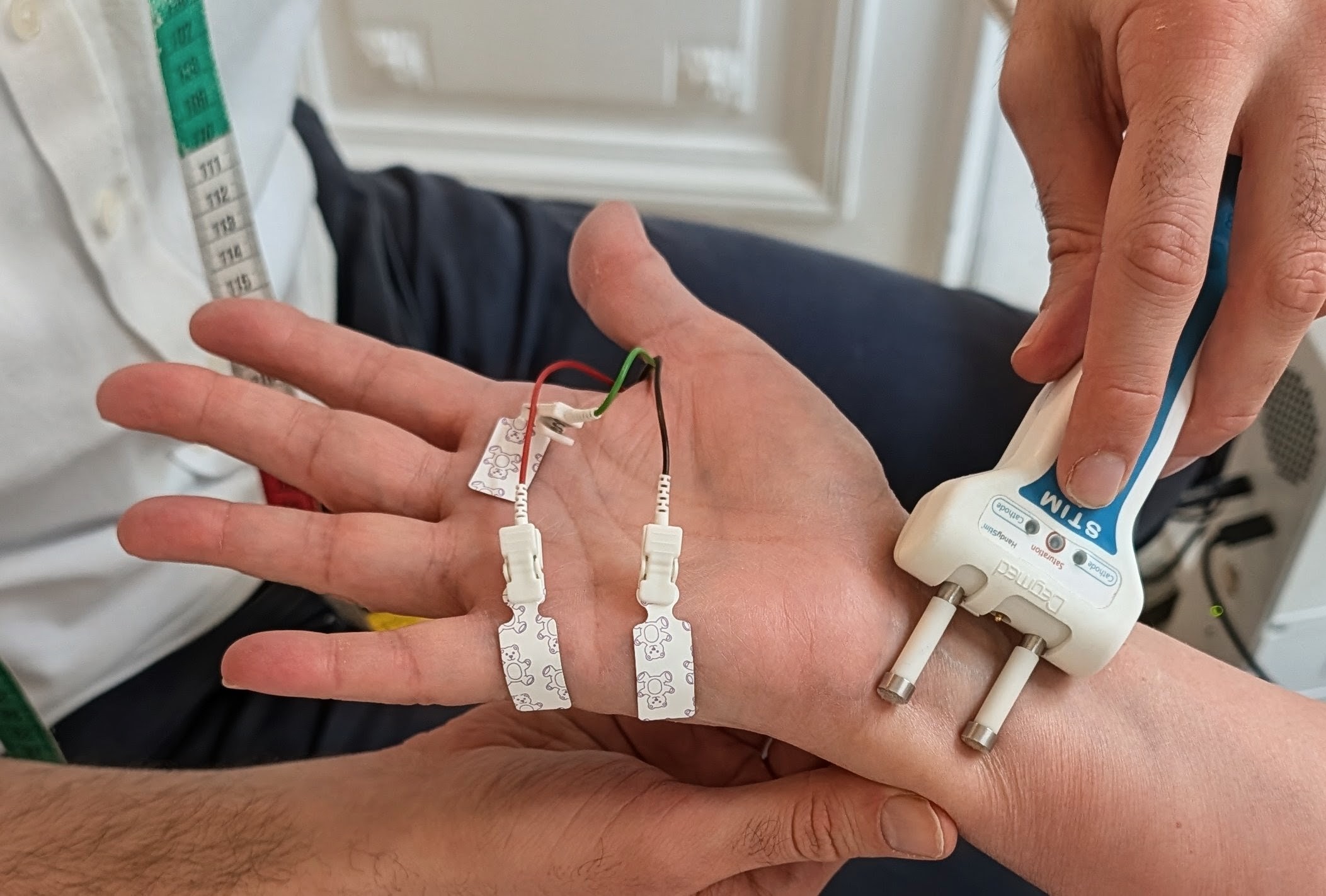 Un EMG au repos peut sous-estimer une compression dynamique : l'interprétation clinique reste essentielle. Équipement EMG et écran de monitoring affichant des tracés de conduction nerveuse dans une salle d'examen clinique